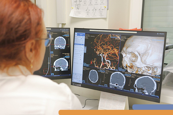 У молодого мужчины с подозрением на инсульт была выявлена опасная патология