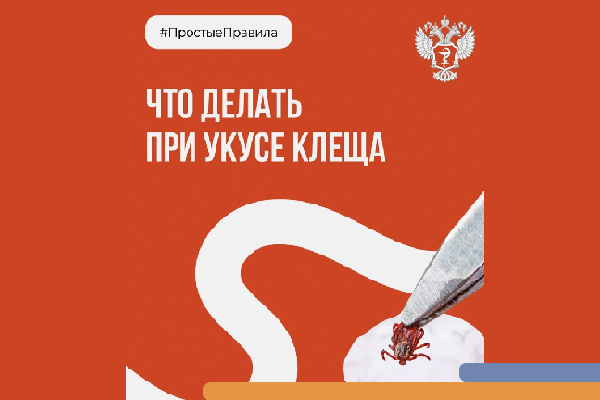 Фотография к новости <strong>ПростыеПравила: Что делать при укусе клеща?</strong>